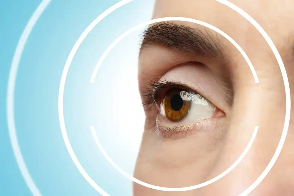 Astigmatisms and myopia