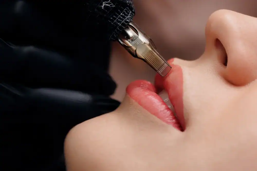 popular skin treatments