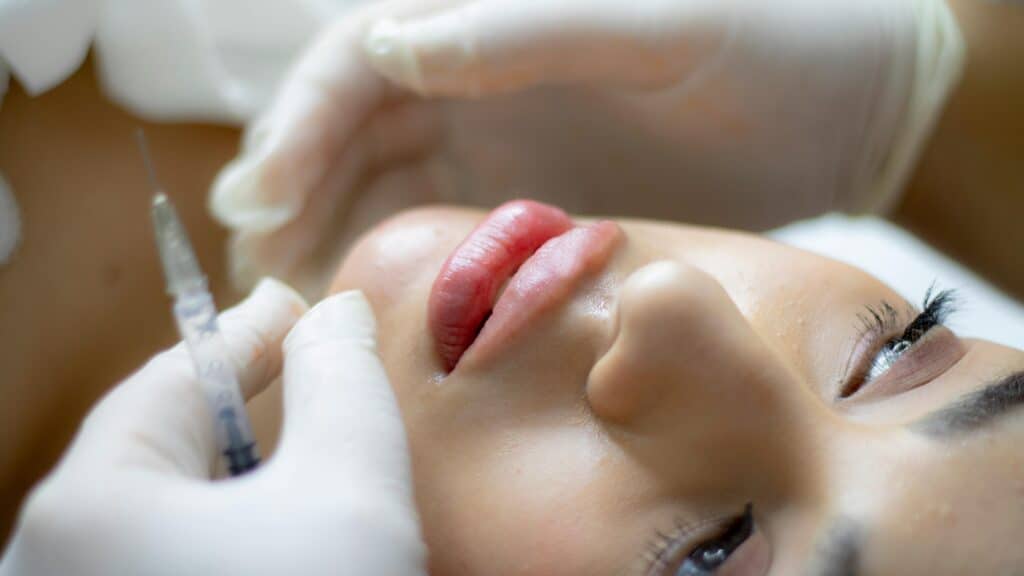 lip flip trend